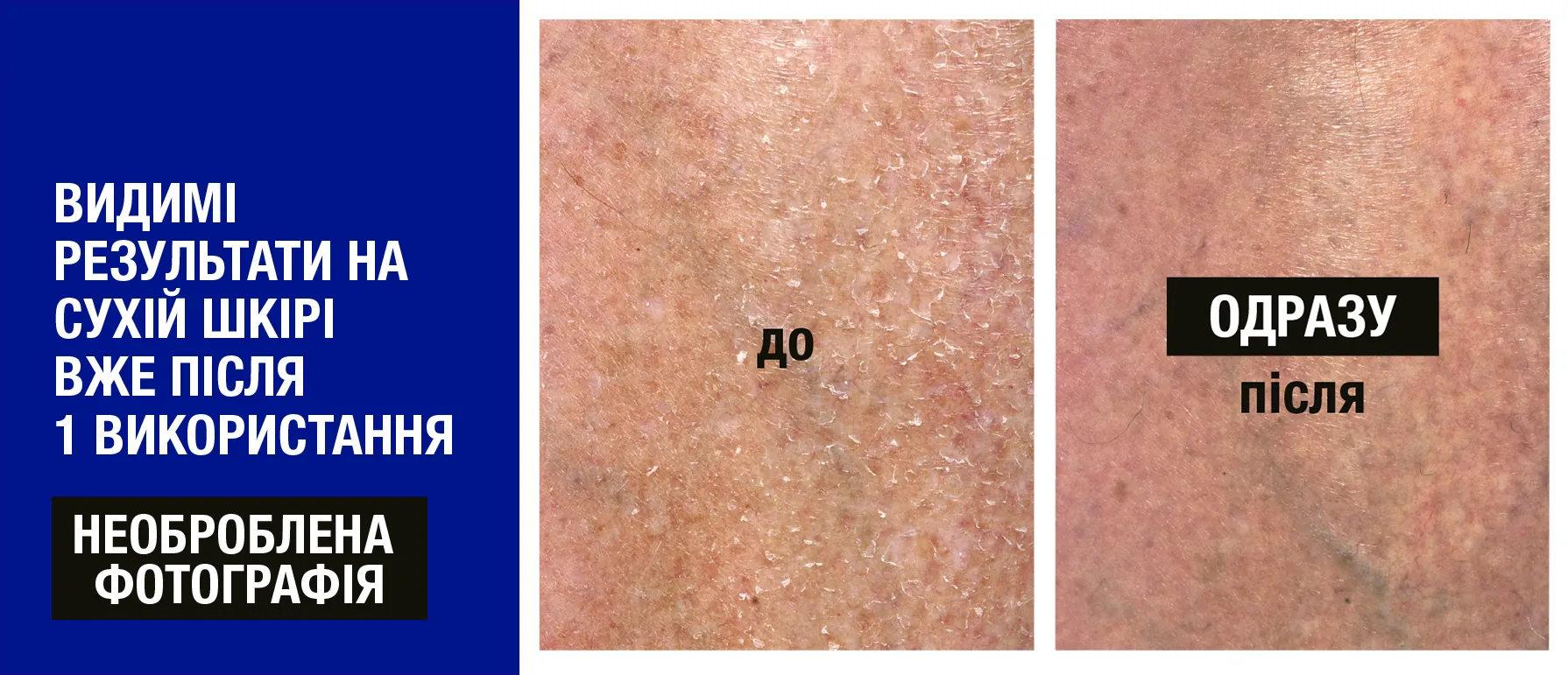 Фото 4 Neutrogena Deep Moisture