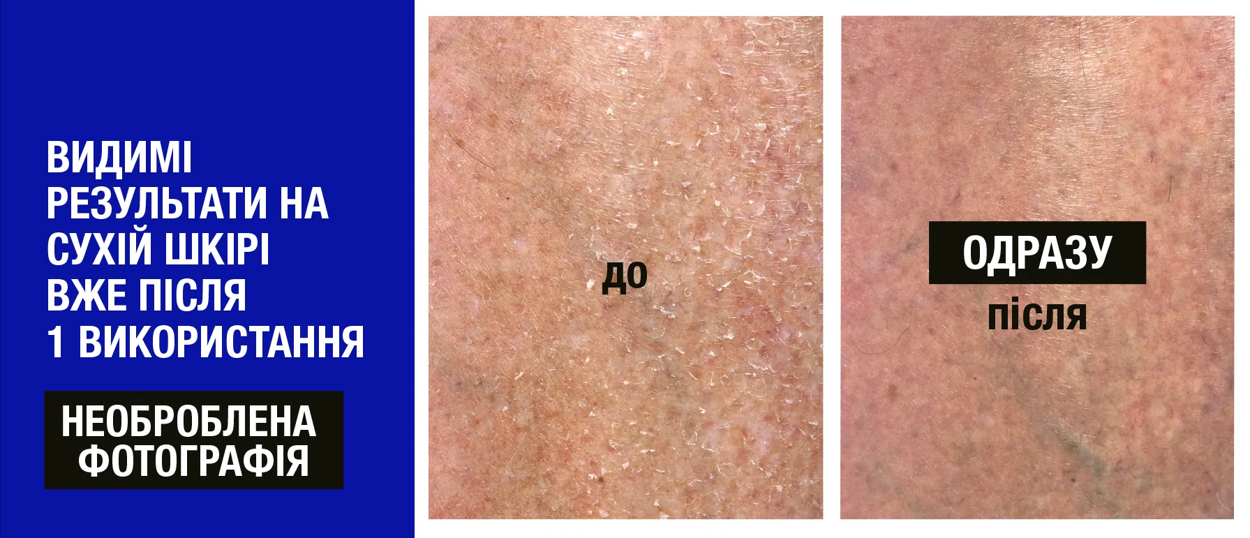 Фото 4 Neutrogena Deep Moisturising Body Lotion Dry Skin